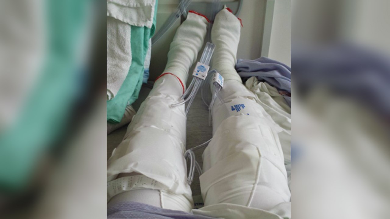 Face au cancer: l'opération avec un grand « O »