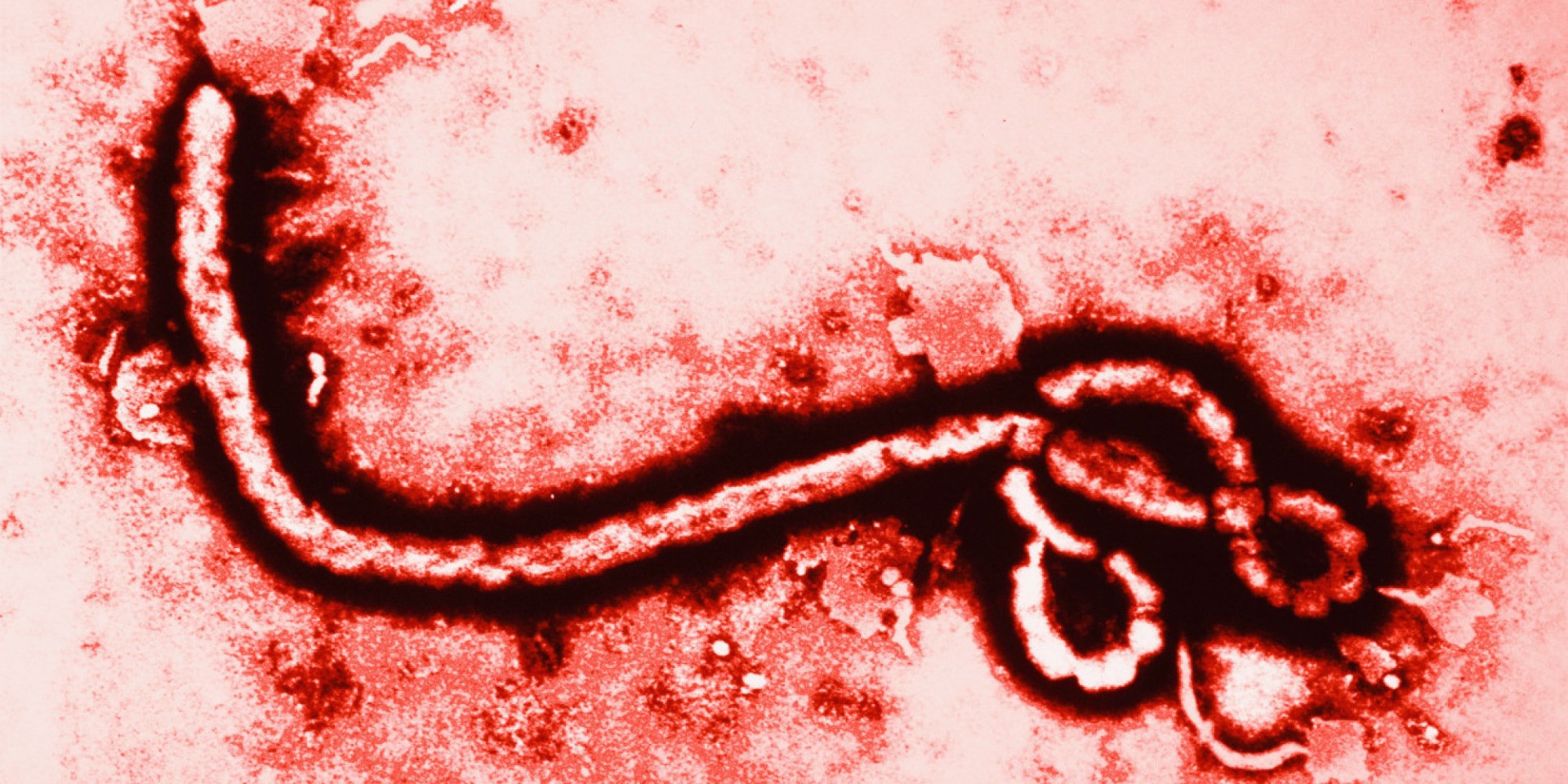 Ebola: le cas est négatif