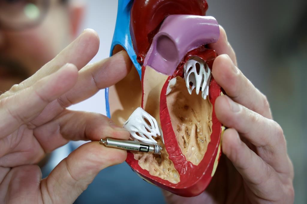 Rapport sur les arrêts cardiaques: une personne sur 10 y survit