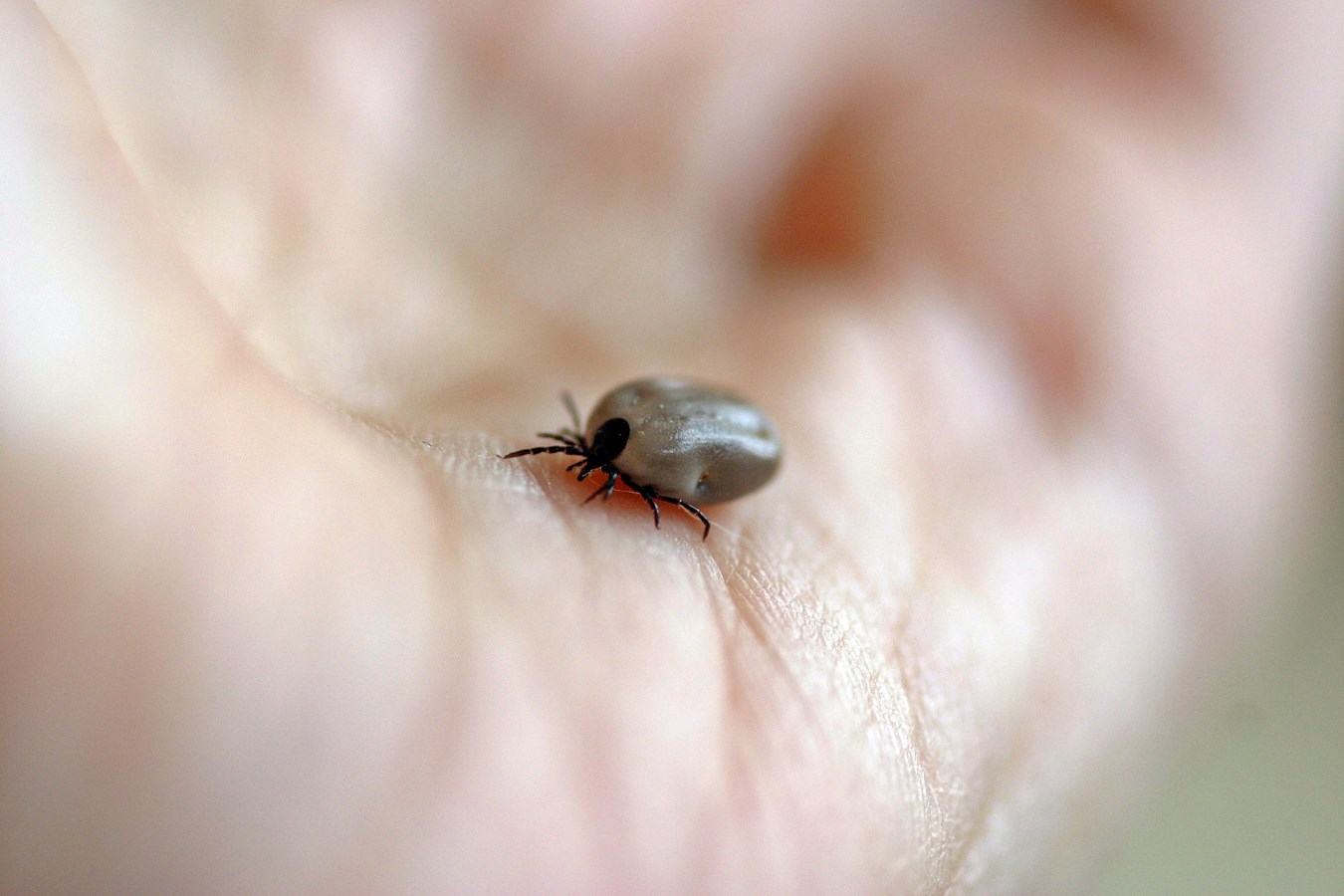 Maladie de Lyme : L’Estrie est la région où l’on rapporte le plus de cas de cette maladie.