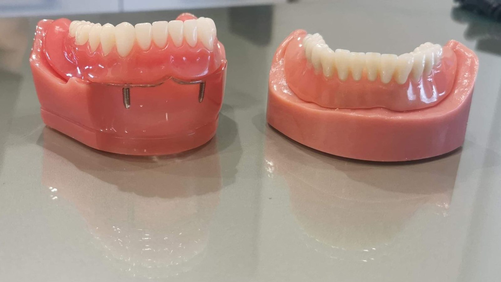 L’un des services à découvrir sur place est sans contredit la pose d’implants dentaires à Valleyfield