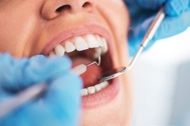 Peut-on éviter la greffe osseuse pour un implant dentaire ?