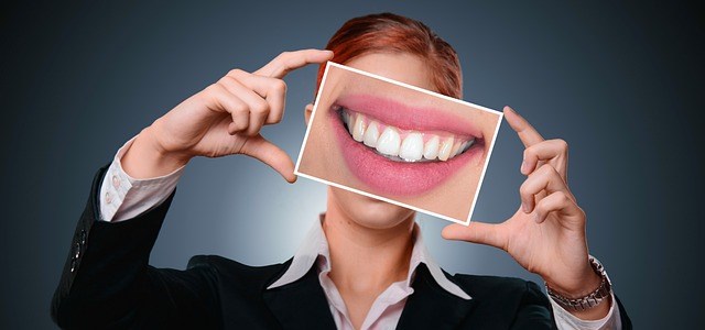 Tout ce qu’il faut savoir sur le blanchiment dentaire