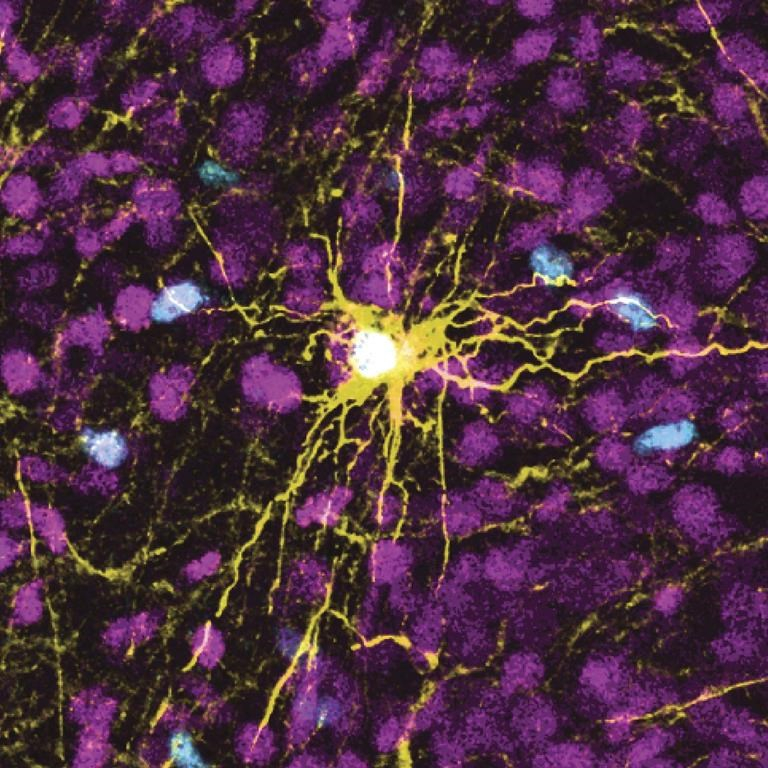 Maladie d'Alzheimer: le rôle du microbiote se précise