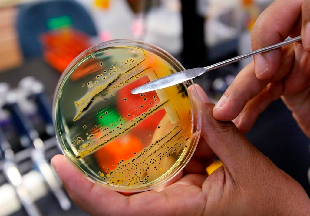 La santé publique du Canada enquête sur une éclosion de salmonelle à travers le pays