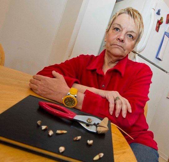 Diane Vinet a elle-même arraché certaines de ses dents à l'aide d'une paire de pinces en 2011. «Le dentiste le moins cher que j’ai trouvé est bien trop cher pour moi. Surtout qu’après ça, il va falloir payer pour la prothèse», avait-elle dit.