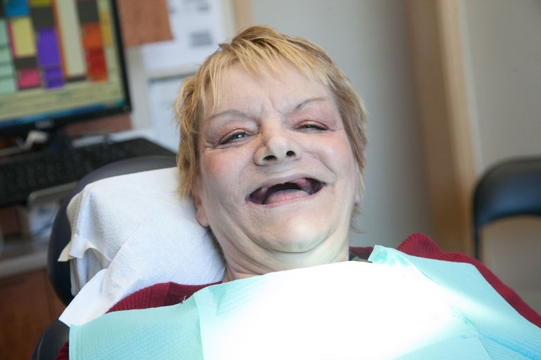 Diane Vinet, qui a elle-même arraché certaines de ses dents à l'aide d'une paire de pinces en 2011, faute d'argent pour consulter un dentiste, juste avant de recevoir une nouvelle dentition du dentiste Philippe Villeneuve.