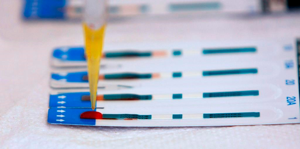 VIH: fin le mois prochain du financement fédéral des tests à domicile