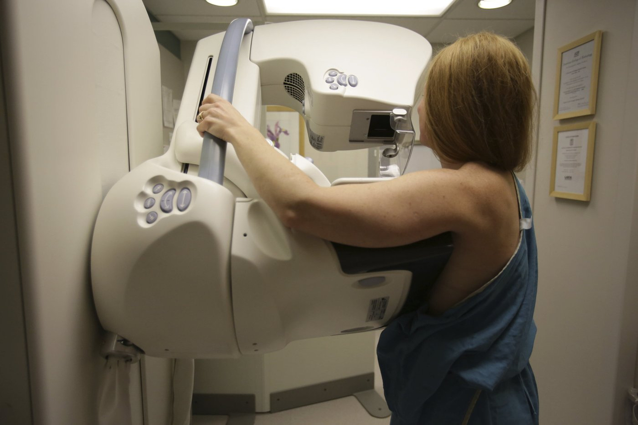 Dépistage du cancer du sein: l'avis de l'INESSS est attendu cet été