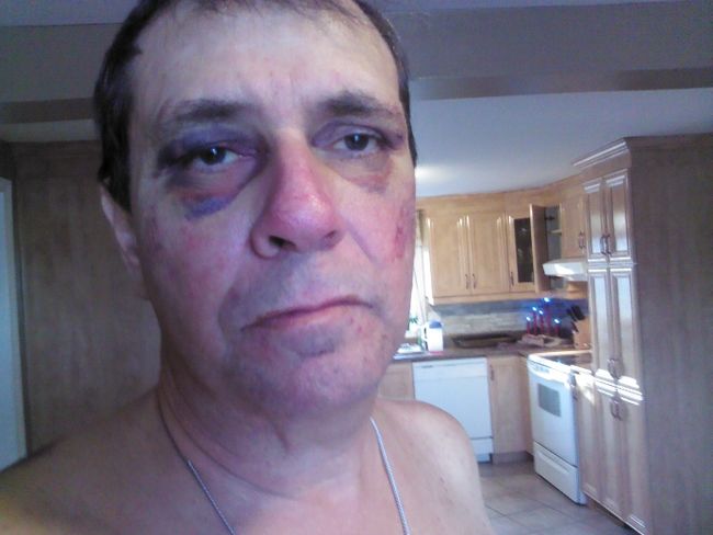 Les policiers se seraient mis à cinq pour maîtriser Raymond Laforme