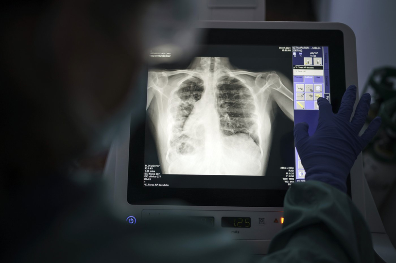Le retour de maladies infectieuses de jadis qui étaient presque disparues au Canada
