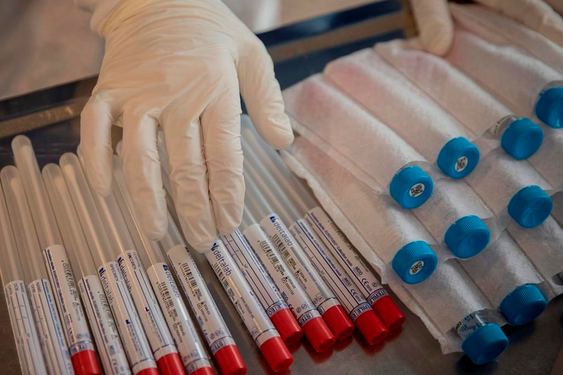Une coalition veut décloisonner le dépistage du VIH au Québec