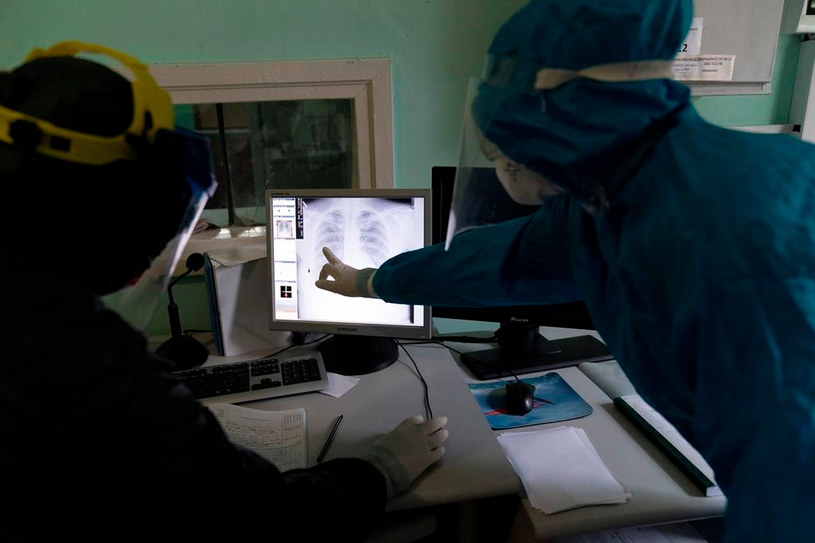 Nouvel espoir dans la lutte au cancer du poumon