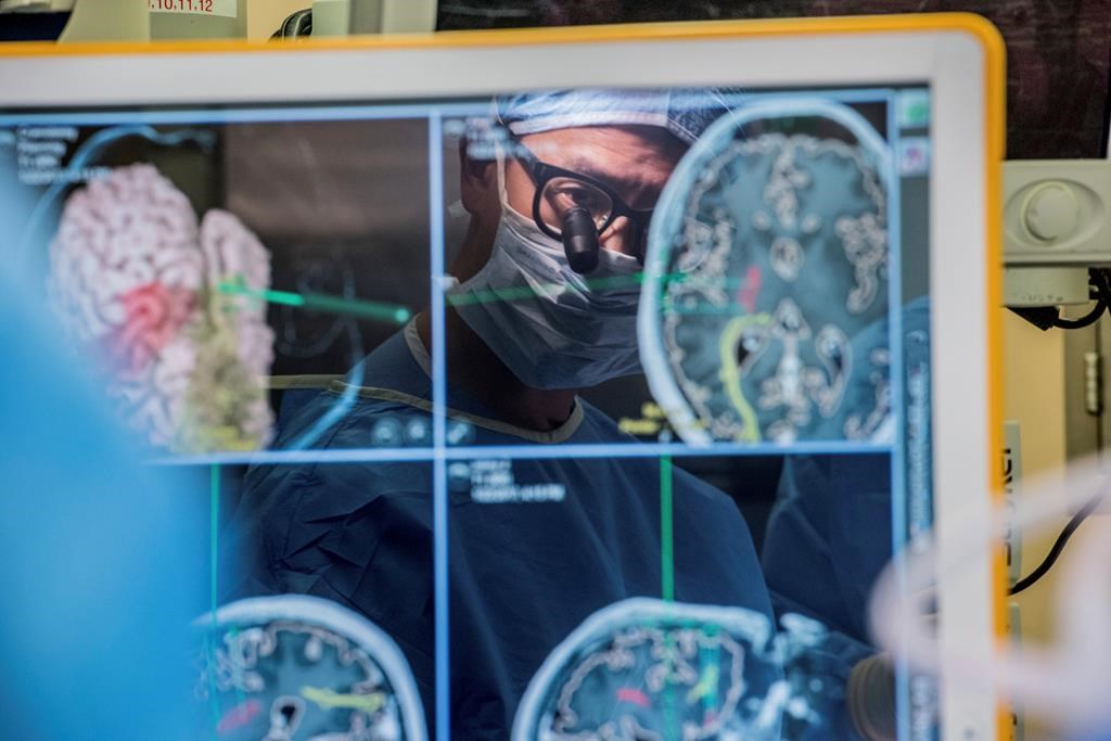Des chercheurs canadiens identifient une nouvelle arme face à l'AVC ischémique