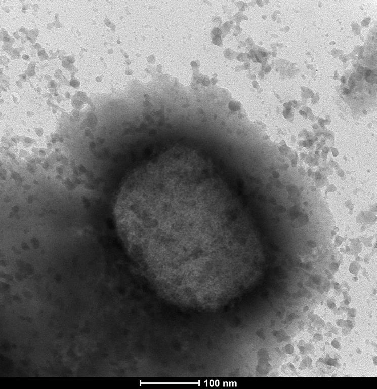 Le nombre de cas de la variole simienne grimpe pour un total de 248 au Québec