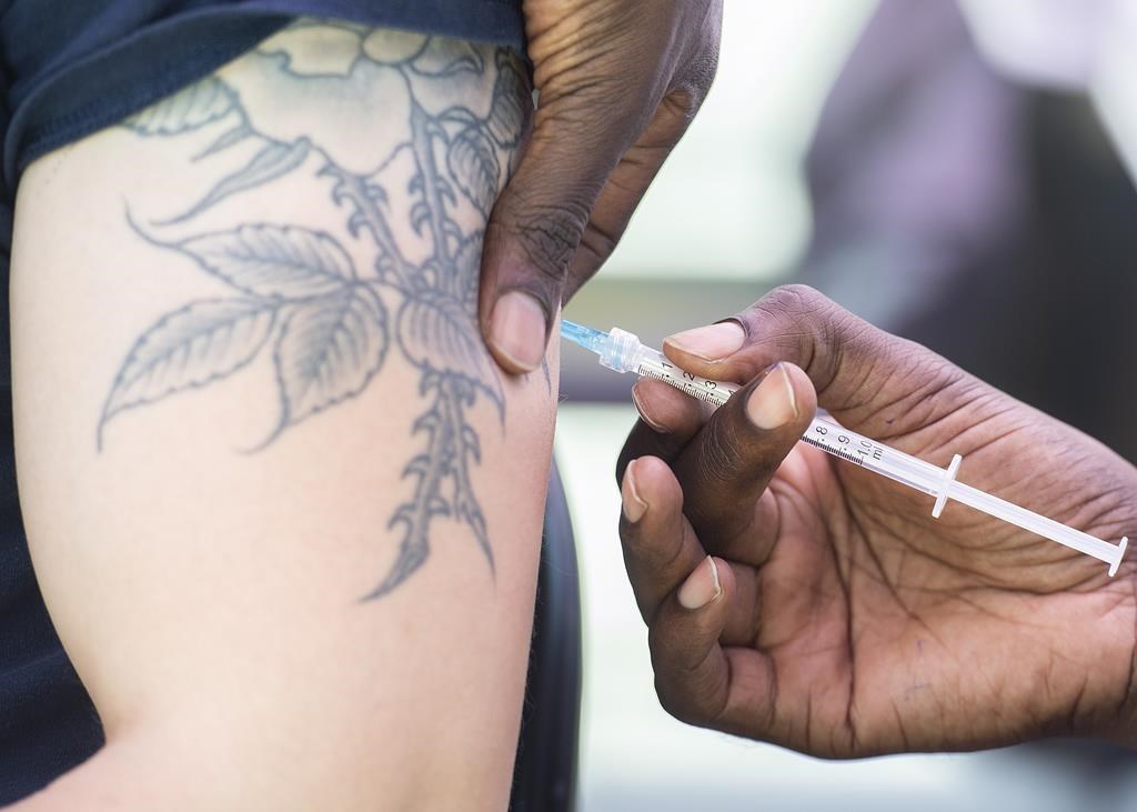 Variole simienne: la Santé publique fédérale invite les hommes à la prudence