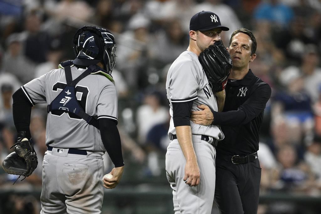 Blessé au coude, le releveur des Yankees Michael King ratera le reste de la saison