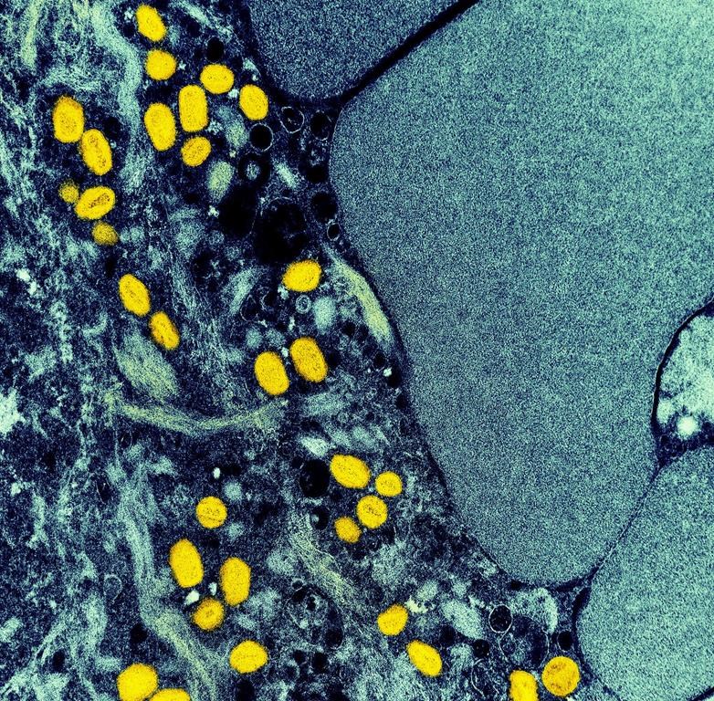 Un premier cas de variole simienne dans la population de la Nouvelle-Écosse