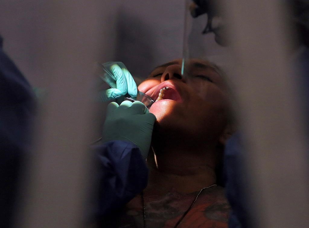 Des groupes demandent une plus grande couverture publique des soins dentaires