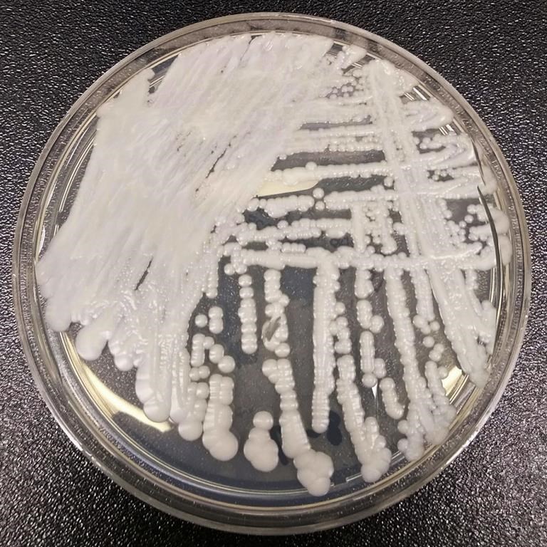 Aucun autre cas de porteur du champignon Candida Auris dépisté à Longueuil