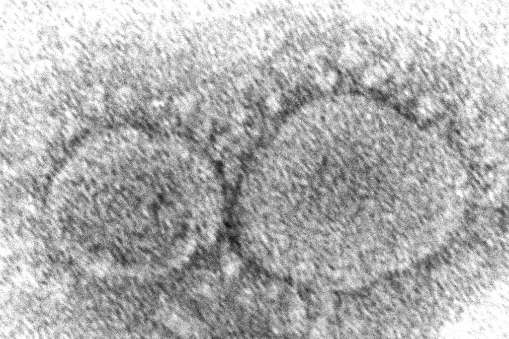 On pourrait détecter le coronavirus sur les planchers