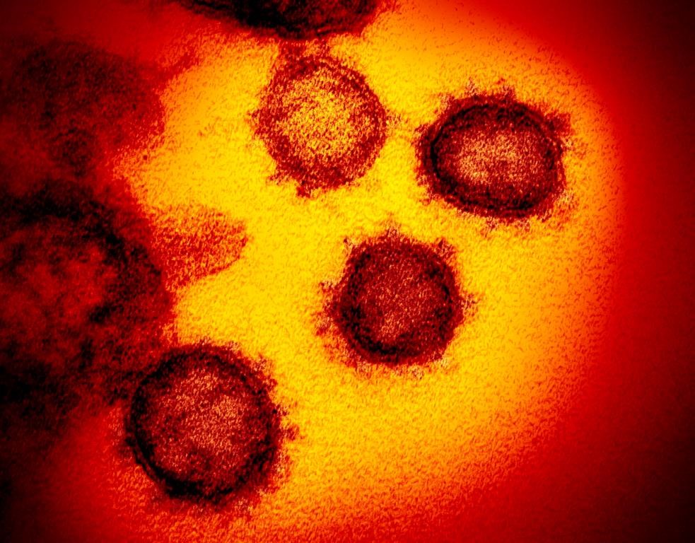 Coronavirus: un nouveau virus créé en laboratoire sème l'émoi
