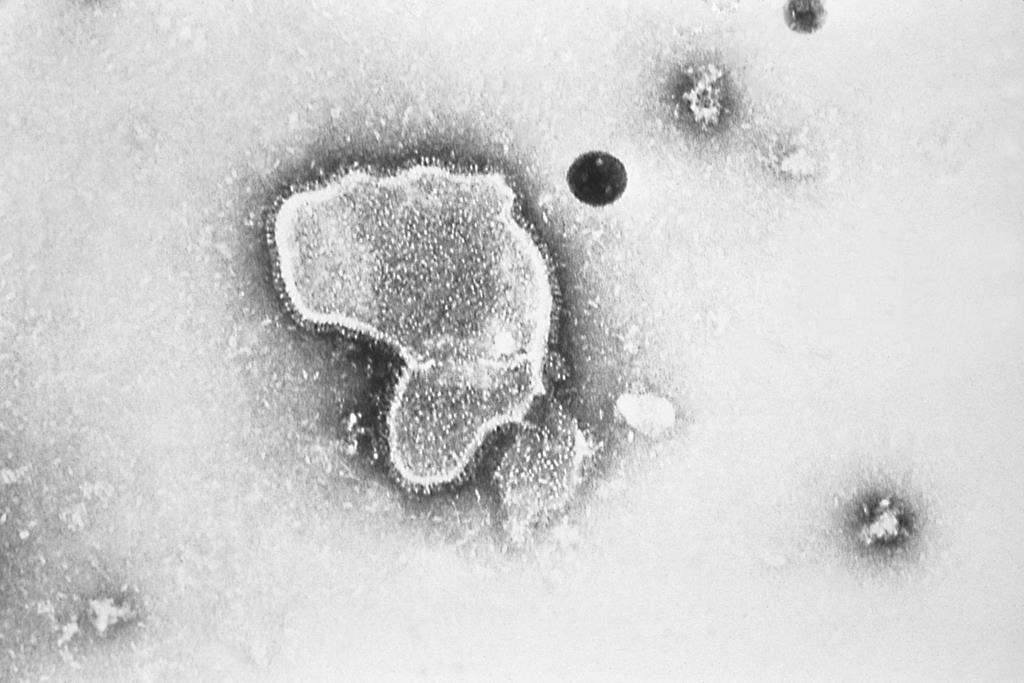 Un antibiotique québécois aide à pallier la pénurie de médicaments pédiatriques