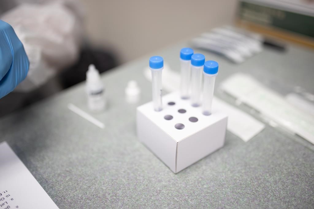 Délais chez Optilab: l'APTS réclame une décentralisation des laboratoires