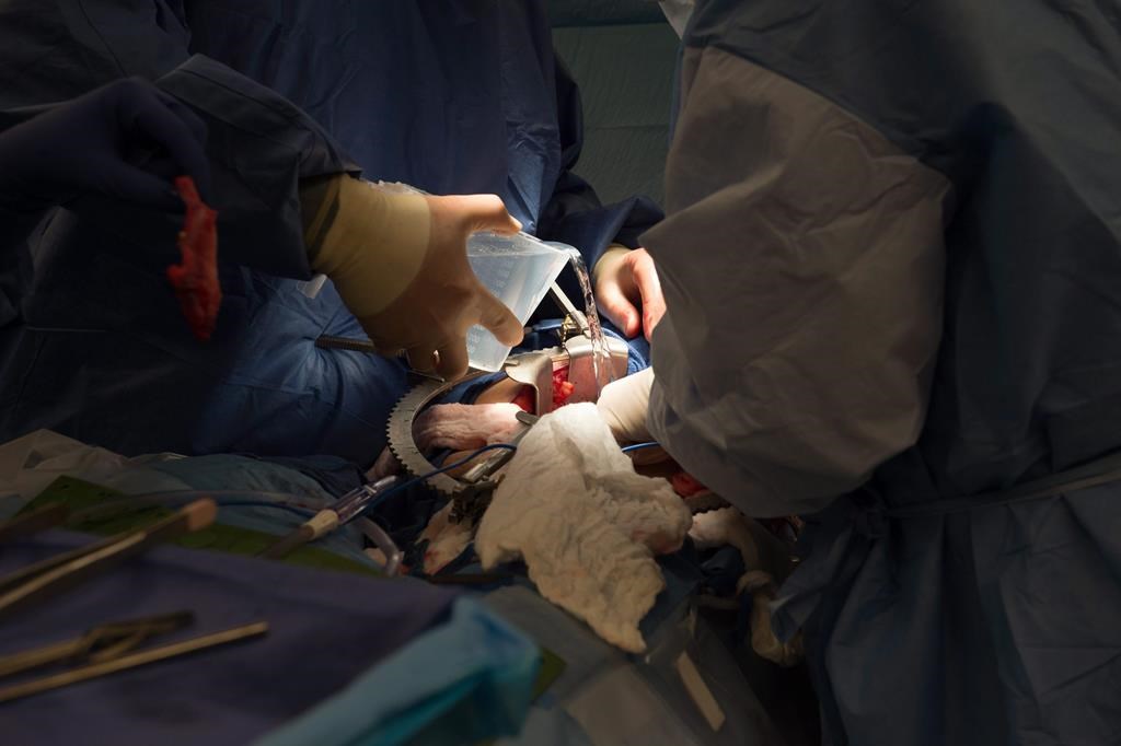 Le nombre de dons d'organes en contexte d'aide médicale à mourir en hausse au Québec