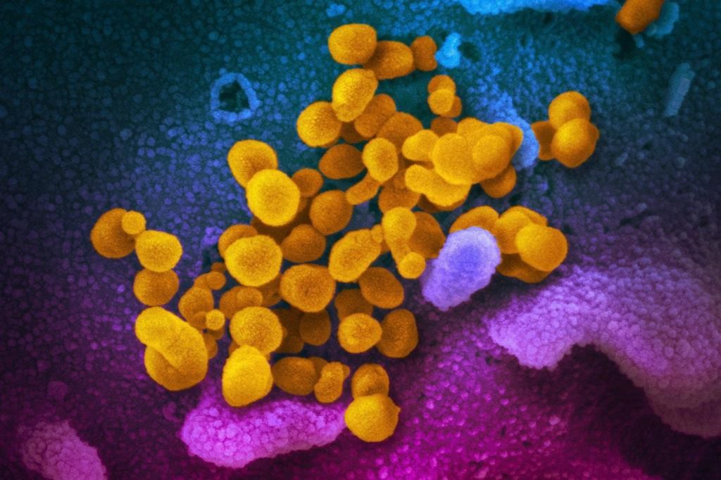 COVID longue: le virus se cacherait dans les muqueuses de l'intestin