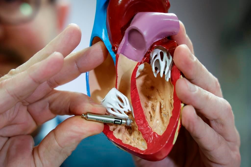 Canada: plus d'arrêts cardiaques que ce qu'estimé et 1 personne sur 10 y survit