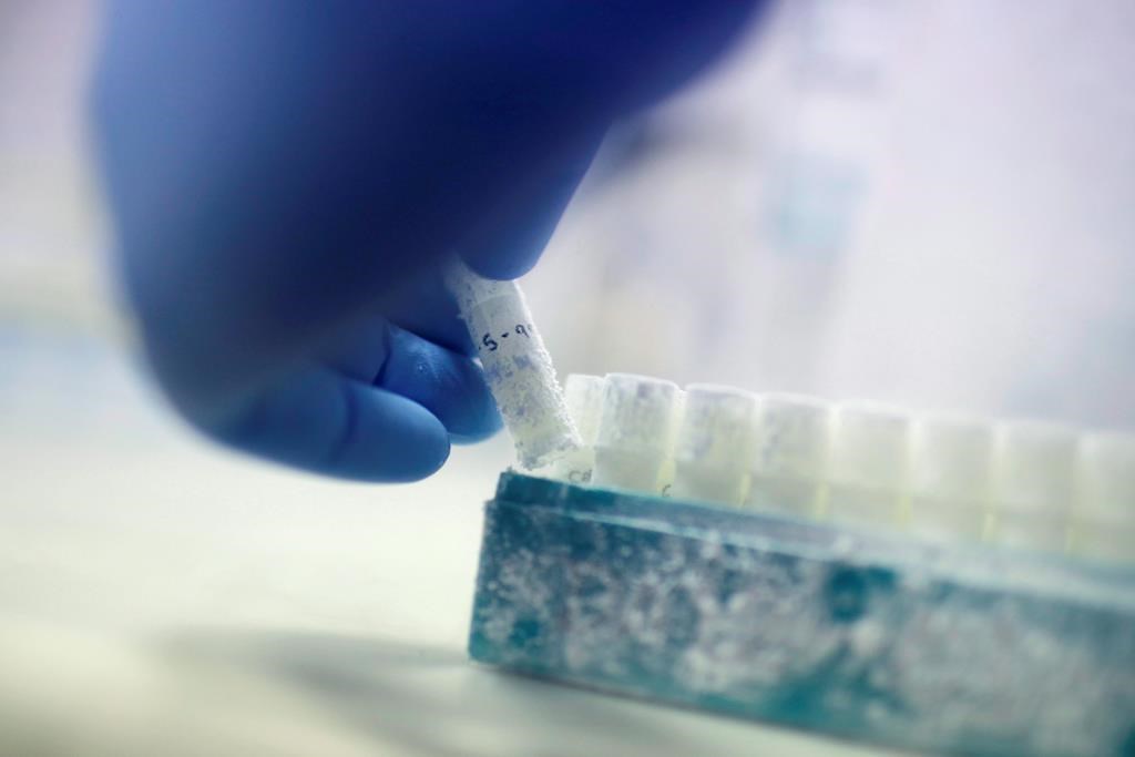 Une bactérie pourrait nuire à la motilité des spermatozoïdes