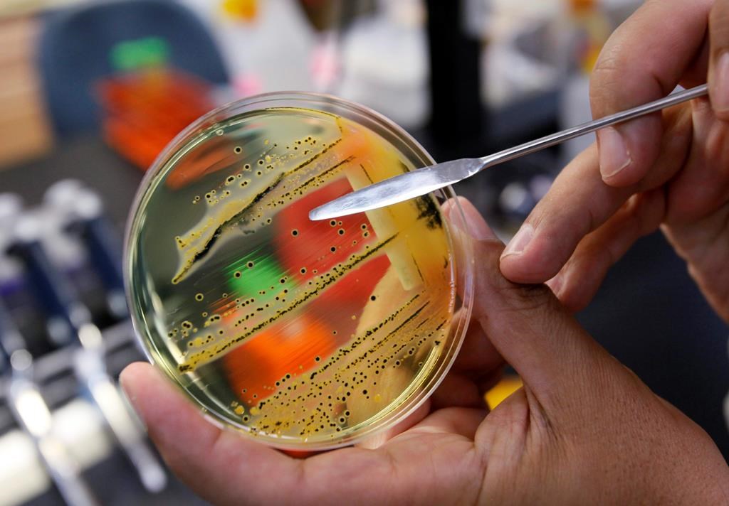 Santé Canada signale une éclosion de salmonellose liée à des reptiles et des rongeurs