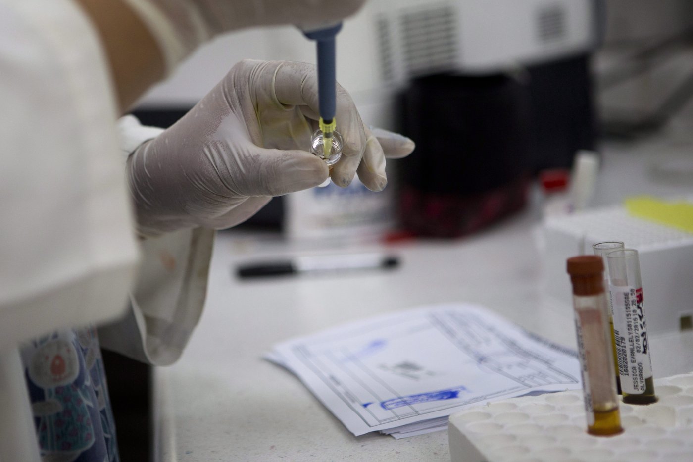 Hausse des cas de syphilis dans les Amériques, qui enregistrent 42 % des nouveaux cas
