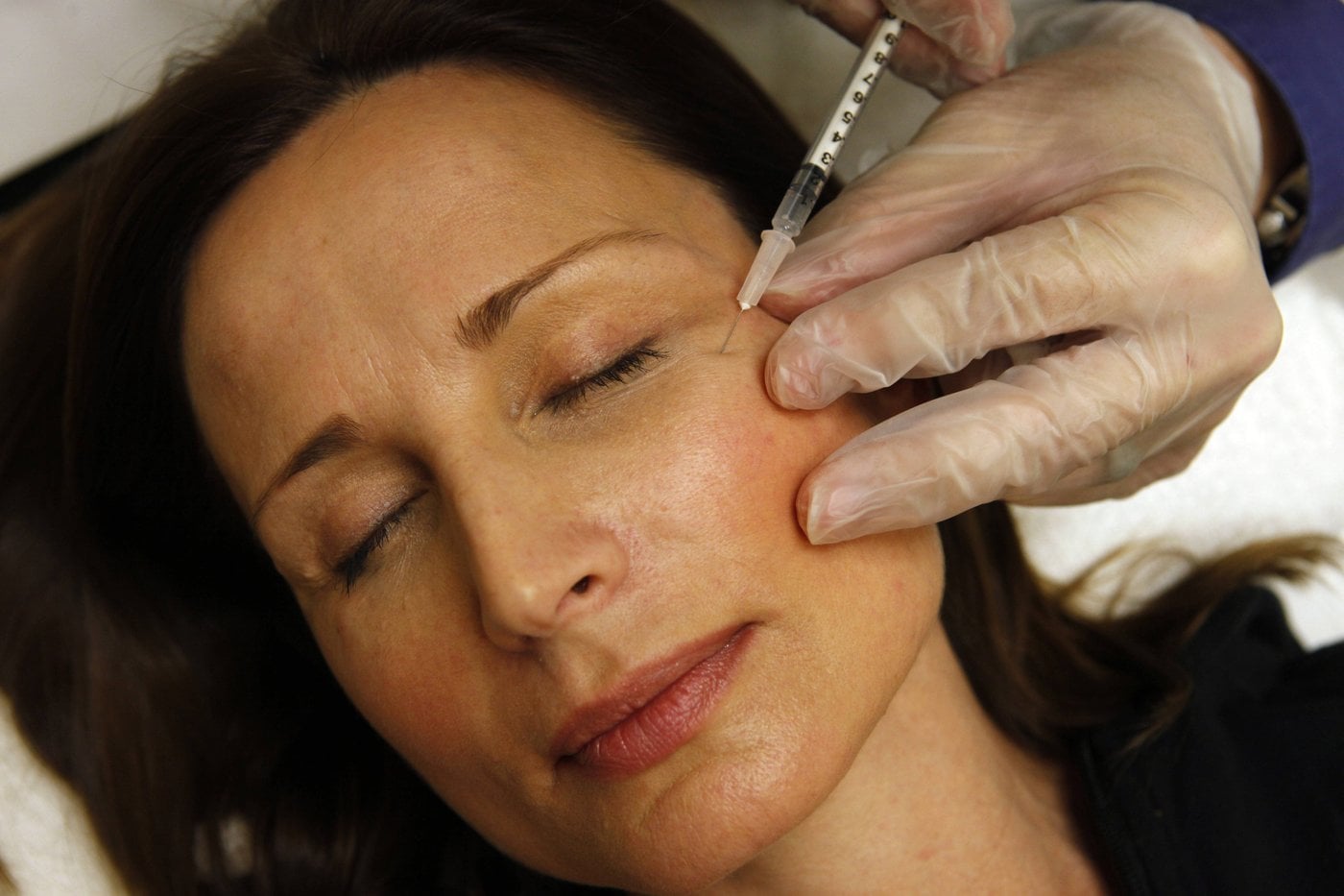Des fautes professionnelles en soins médico-esthétiques, avertissent le CMQ et l'OIIQ