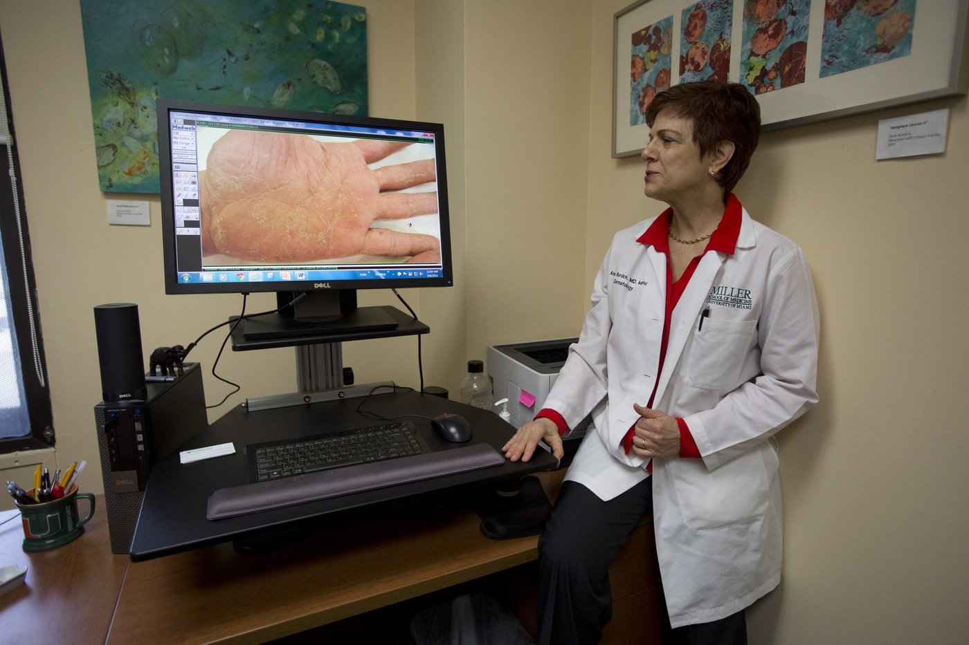 La télédermatologie est un succès, selon l'AMSDQ, mais l'attente reste un enjeu