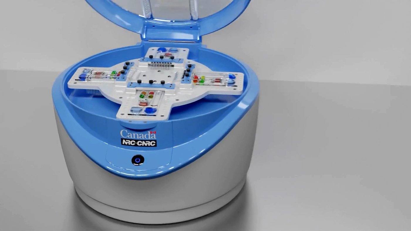 Des chercheurs canadiens développent un test rapide pour la septicémie
