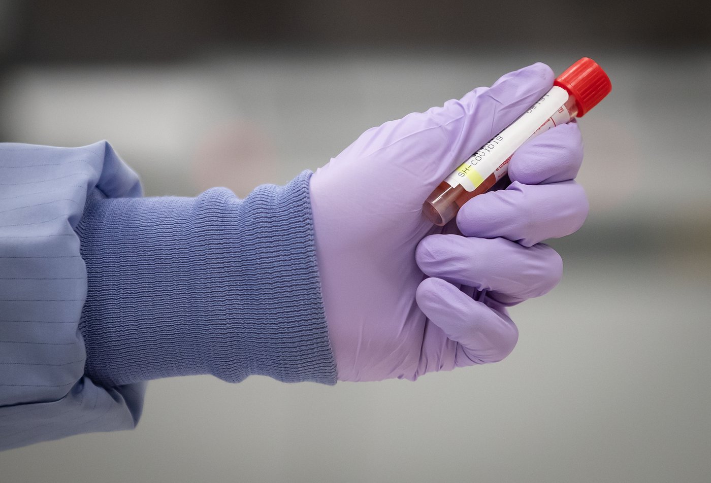 Laboratoire de l'INSPQ: les techniciens se dotent d'un mandat de grève