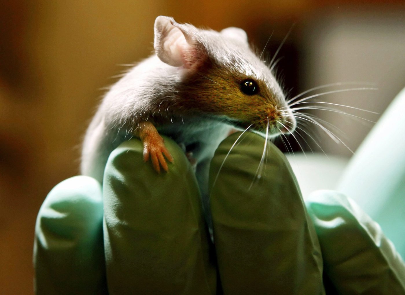 Les cellules cancéreuses produisent une protéine qui semble combattre l'alzheimer