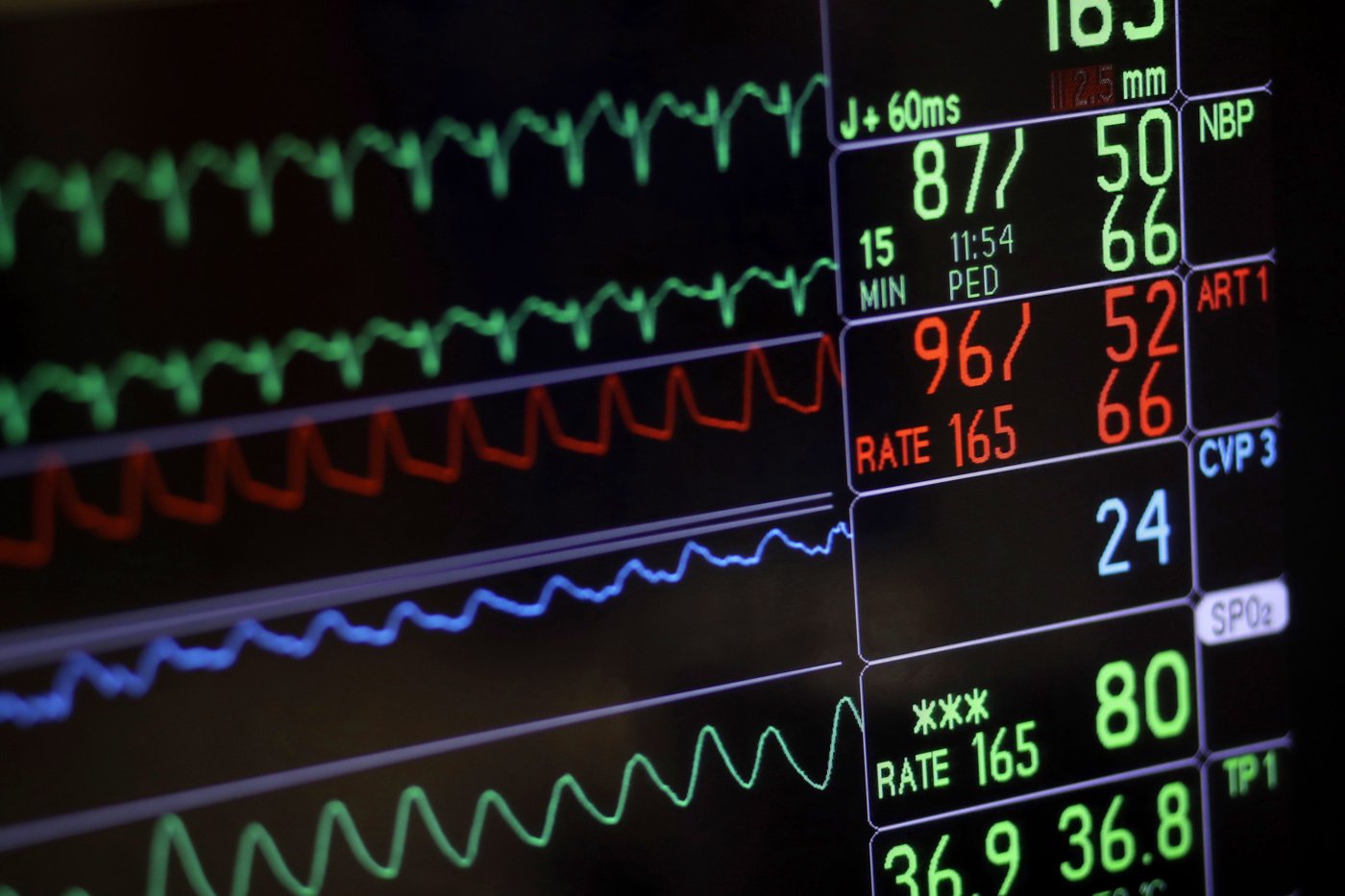 Au Canada, la plupart des décès assistés surviennent après un diagnostic de cancer