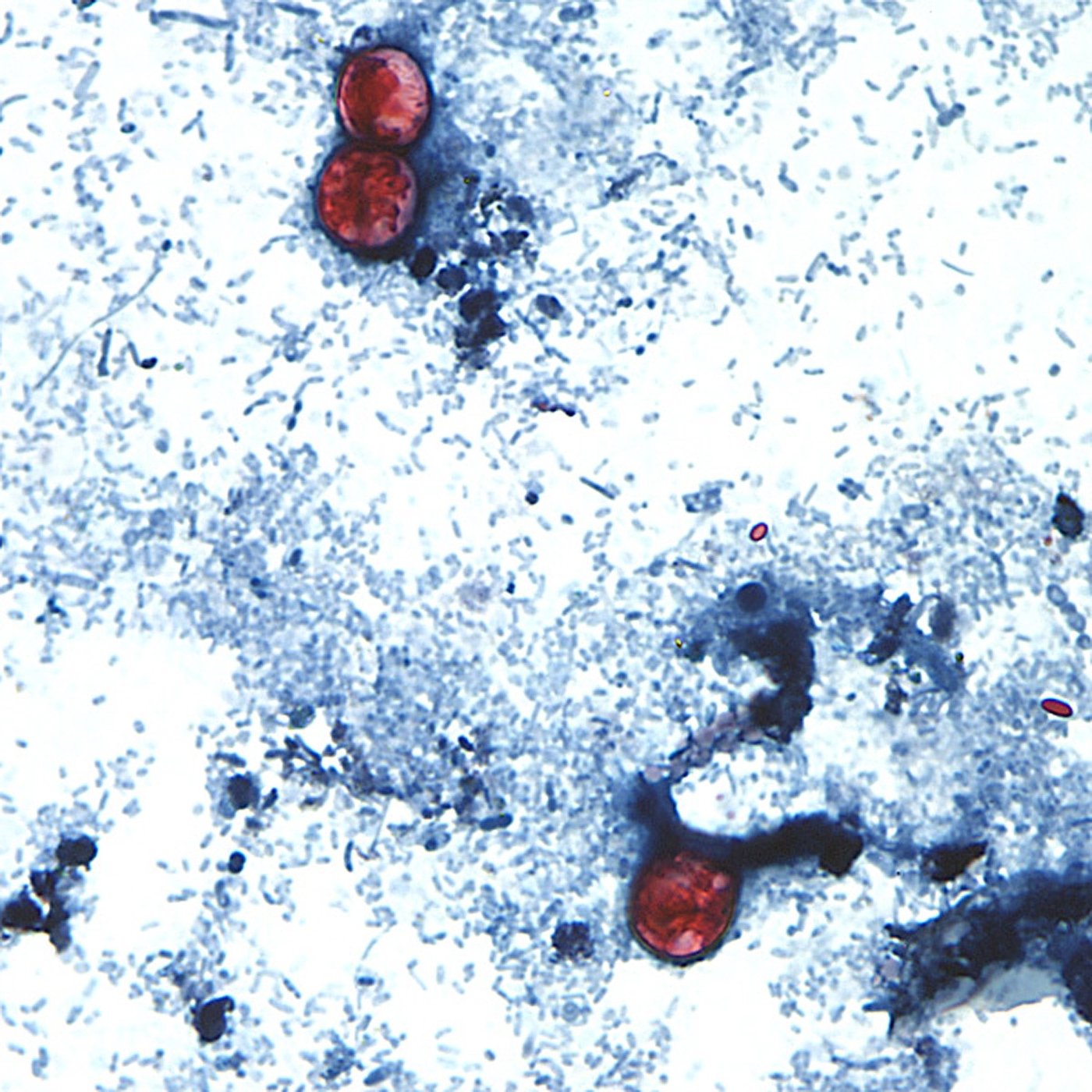L'ACIA ne s'inquiète pas de l'importation d'aliments contaminés par le Cyclospora