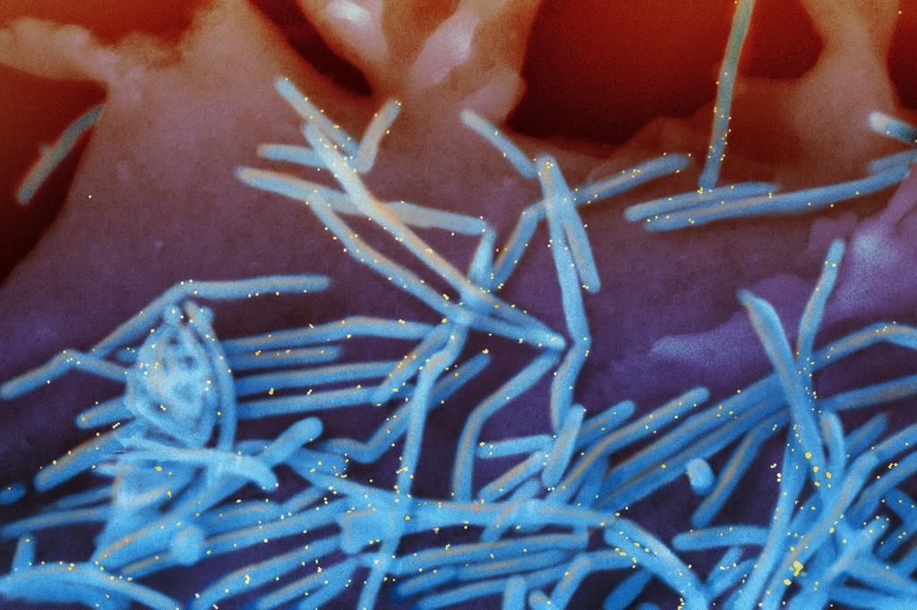 Toujours pas de vaccin pour protéger les enfants contre le VRS